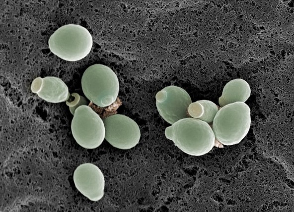 Yeast: A Technical History