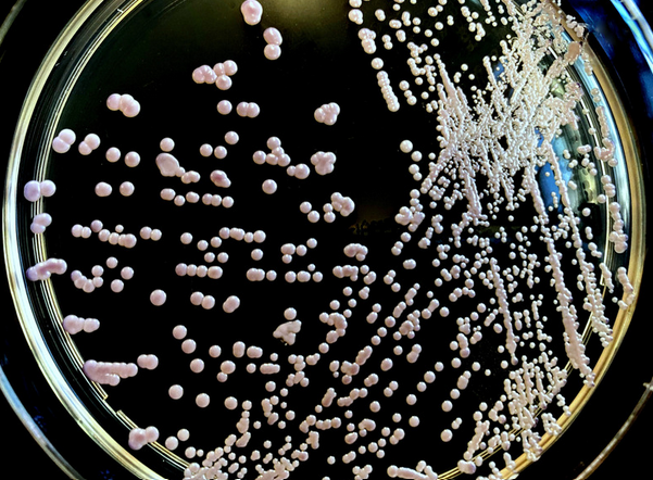 Yeast Nutrition- Ensuring Your Yeast’s Health